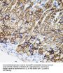 Matrix Metalloproteinase-9 (MMP9) Antibody