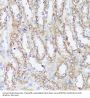 Bifunctional Methylenetetrahydrofolate Dehydrogenase/cyclohydrolase, Mitochondrial (MTHFD2) Antibody