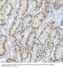 Bifunctional Methylenetetrahydrofolate Dehydrogenase/cyclohydrolase, Mitochondrial (MTHFD2) Antibody
