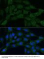 Bifunctional Methylenetetrahydrofolate Dehydrogenase/cyclohydrolase, Mitochondrial (MTHFD2) Antibody
