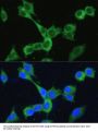 Bifunctional Methylenetetrahydrofolate Dehydrogenase/cyclohydrolase, Mitochondrial (MTHFD2) Antibody