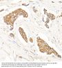 NF-Kappa-B Inhibitor Alpha (NFKBIA) Antibody
