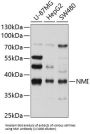 N-Myc-Interactor (NMI) Antibody