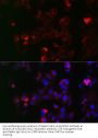 NADPH Oxidase 1 (NOX1) Antibody