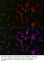 NADPH Oxidase 1 (NOX1) Antibody