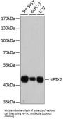 Neuronal Pentraxin-2 (NPTX2) Antibody