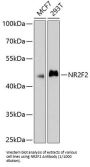 COUP Transcription Factor 2 (NR2F2) Antibody