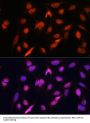 Otubain 1 (OTUB1) Antibody