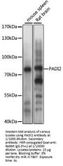 Protein-Arginine Deiminase Type-2 (PADI2) Antibody