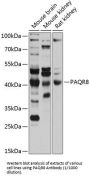 Membrane Progestin Receptor Beta (PAQR8) Antibody