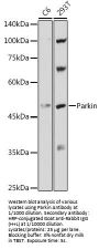 E3 Ubiquitin-Protein Ligase Parkin (PRKN) Antibody