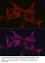 E3 Ubiquitin-Protein Ligase Parkin (PRKN) Antibody