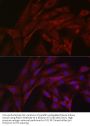 E3 Ubiquitin-Protein Ligase Parkin (PRKN) Antibody