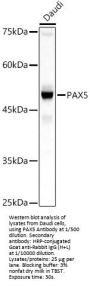 Paired Box Protein Pax-5 (PAX5) Antibody