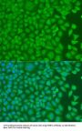 Poly(RC) Binding Protein 1 (PCBP1) Antibody