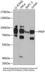 ATP-Dependent 6-Phosphofructokinase, Platelet Type (PFKP) Antibody
