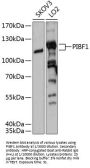 Progesterone-Induced-Blocking Factor 1 (PIBF1) Antibody