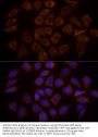 Phosphatidylinositol 3-Kinase Regulatory Subunit Alpha (PIK3R1) Antibody