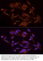 Phosphatidylinositol 3-Kinase Regulatory Subunit Alpha (PIK3R1) Antibody