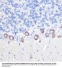 Phospholipase C Beta 3, Phosphoinositide Specific (PLCB3) Antibody