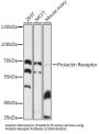 Prolactin Receptor (PRLR) Antibody
