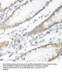 Phosphatidylinositol-3,4,5-Trisphosphate 3-Phosphatase And Dual-Specificity Protein Phosphatase PTEN (PTEN) Antibody