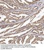 Phosphatidylinositol-3,4,5-Trisphosphate 3-Phosphatase And Dual-Specificity Protein Phosphatase PTEN (PTEN) Antibody