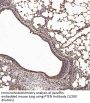 Phosphatidylinositol-3,4,5-Trisphosphate 3-Phosphatase And Dual-Specificity Protein Phosphatase PTEN (PTEN) Antibody
