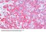 Phosphatidylinositol-3,4,5-Trisphosphate 3-Phosphatase And Dual-Specificity Protein Phosphatase PTEN (PTEN) Antibody