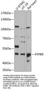 Protein Tyrosine Phosphatase, Receptor Type R (PTPRR) Antibody