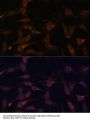 Ras-Related Protein Rab-21 (RAB21) Antibody