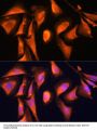 Ras-Related Protein Rab-21 (RAB21) Antibody