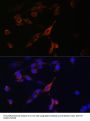 Ras-Related Protein Rab-21 (RAB21) Antibody