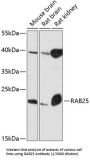RAB25, Member RAS Oncogene Family (RAB25) Antibody