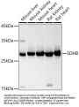 Succinate Dehydrogenase Complex Subunit B (SDHB) Antibody