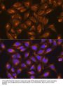 Succinate Dehydrogenase Complex Subunit B (SDHB) Antibody