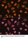 Succinate Dehydrogenase Complex Subunit B (SDHB) Antibody