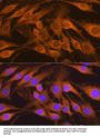 Succinate Dehydrogenase Complex Subunit B (SDHB) Antibody