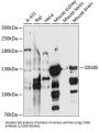 SIN3 Transcription Regulator Family Member B (SIN3B) Antibody