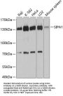 Signal-Induced Proliferation-Associated Protein 1 (SIPA1) Antibody