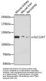 Solute Carrier Family 12 Member 7 (SLC12A7) Antibody