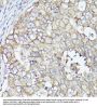 Monocarboxylate Transporter 4 / MCT4 (SLC16A3) Antibody