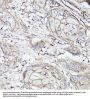 Monocarboxylate Transporter 4 / MCT4 (SLC16A3) Antibody
