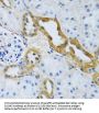 Electrogenic Sodium Bicarbonate Cotransporter 4 / NBC4 (SLC4A5) Antibody