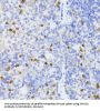 Mothers Against Decapentaplegic Homolog 2 (Smad2) Antibody