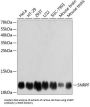 Small Nuclear Ribonucleoprotein Polypeptide F (SNRPF) Antibody