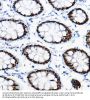 Transcription Factor SOX-9 (SOX9) Antibody