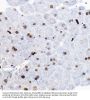 Transcription Factor SOX-9 (SOX9) Antibody
