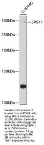 Spatacsin (SPG11) Antibody
