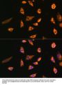 Small Proline Rich Protein 3 (SPRR3) Antibody